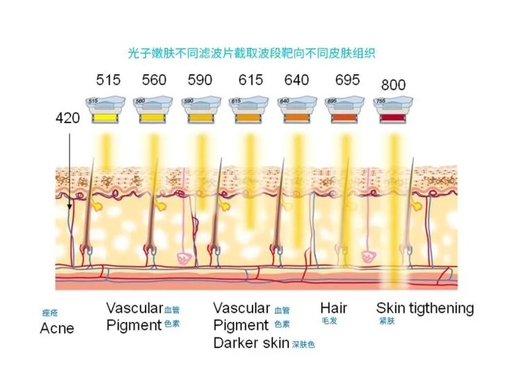 五大光子嫩膚技術(shù)（IPL、DPL、OPT、APT、BBL）及濾光片區(qū)別
